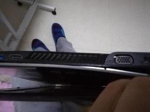 头条螺丝掉了怎么办